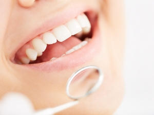 Denti sensibili