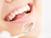 Denti sensibili