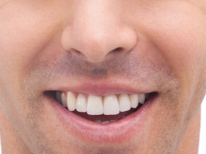 Alveolite secca