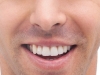 Alveolite secca